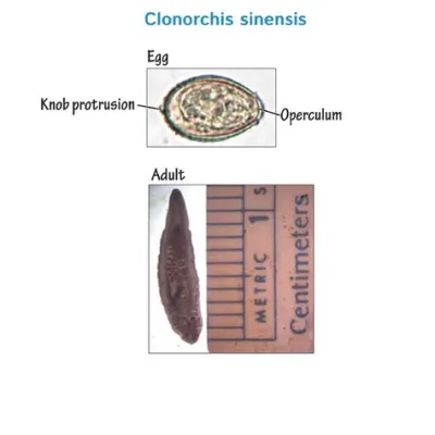  Clonorchis Sinensis - Ein Trematode mit Vorliebe für fette Fischleber!